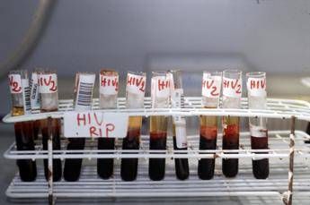 Sesso non protetto con Hiv, arrestato untore Sesso non protetto con Hiv, arrestato untore