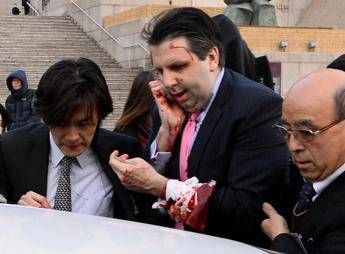 Corea del Sud, ambasciatore Usa aggredito e ferito a coltellate Corea del Sud, ambasciatore Usa aggredito e ferito a coltellate
