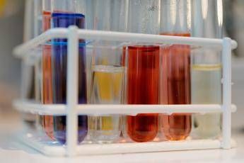Verso un test del sangue per scoprire l'Alzheimer Verso un test del sangue per scoprire l'Alzheimer