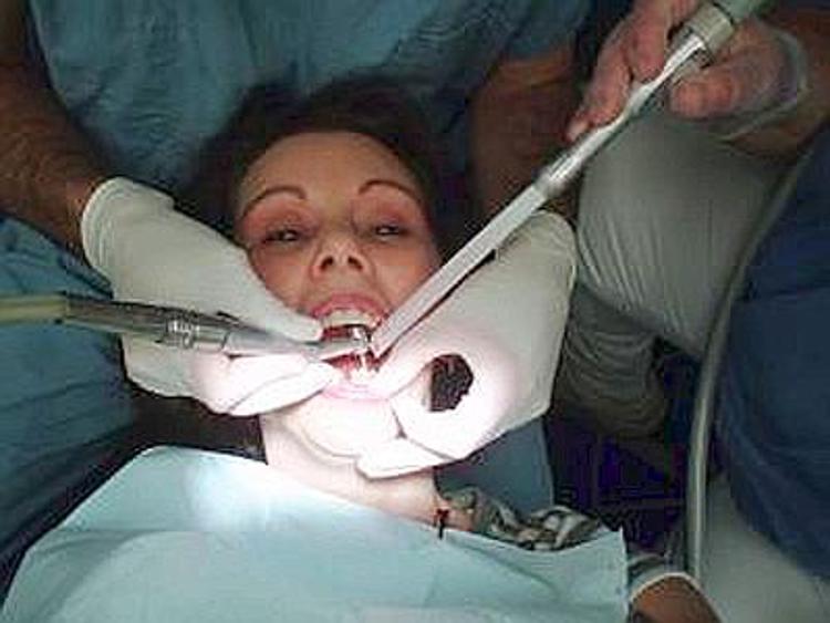 Salute: denti sani scudo contro artrite, studio la collega a batterio bocca
