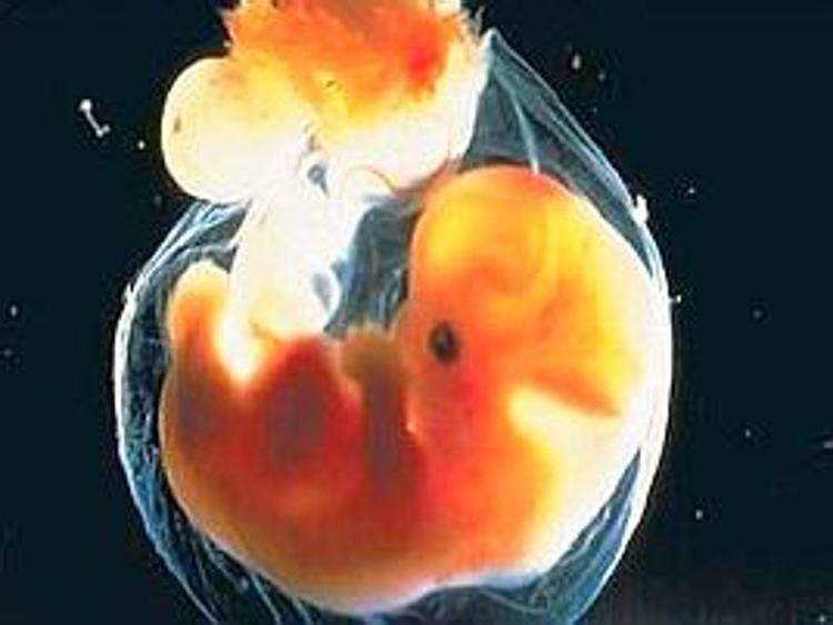 Scambio embrioni, confermata incompatibilità genetica