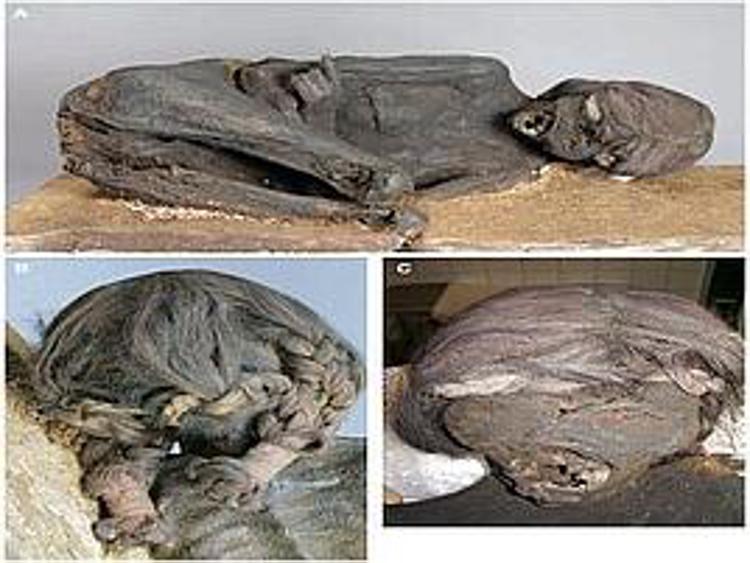 Studio mummia Inca con malattia tropicale svela delitto