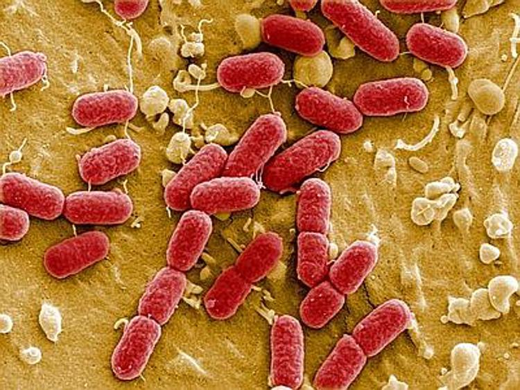 Oms lancia allarme: super batteri devastanti, vecchie infezioni tornano a uccidere