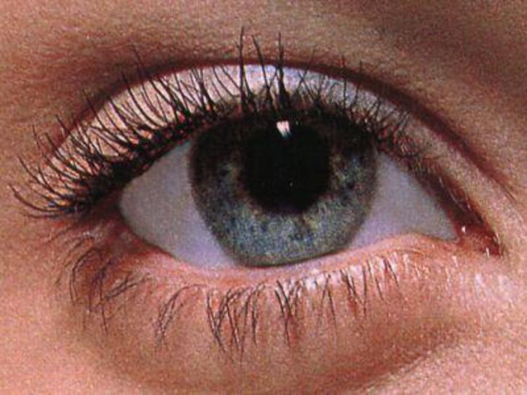 Medicina: occhio pigro, più stimoli ad hoc per batterlo anche da grandi