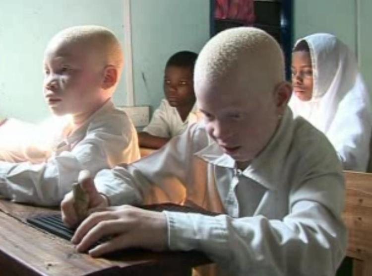 Tanzania: massacro degli albini, arrestati più di 200 stregoni