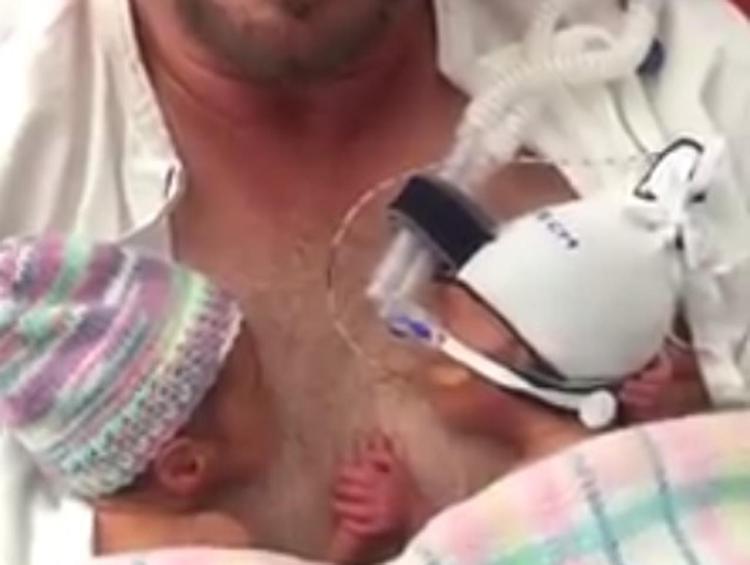 Nati prematuri, si tengono stretti per mano: il video dei gemellini commuove il web /Guarda