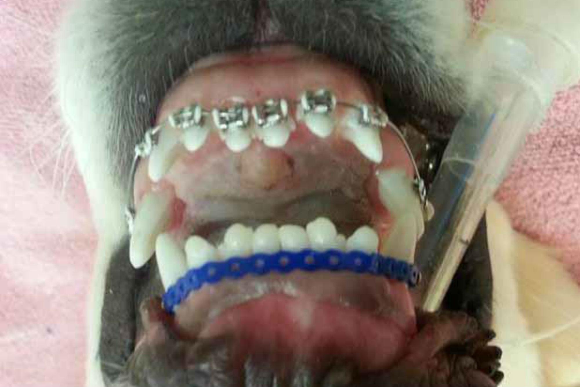 Coronavirus: problemi ai denti, cosa fare in caso di urgenza