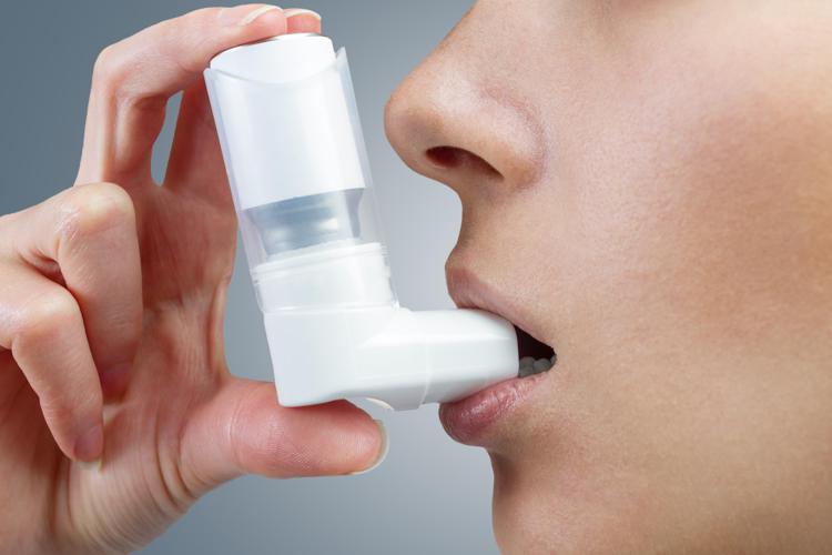 Sanità: asma e Bpco ladre di respiro e di Pil, costano a Ssn 14 mld l'anno
