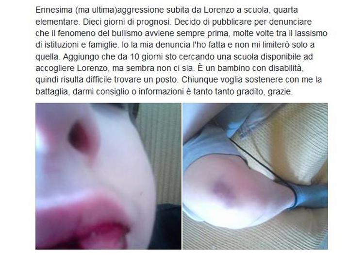Il post-denuncia su Facebook di Cinzia Miatton, mamma di un piccolo disabile vittima di bullismo 