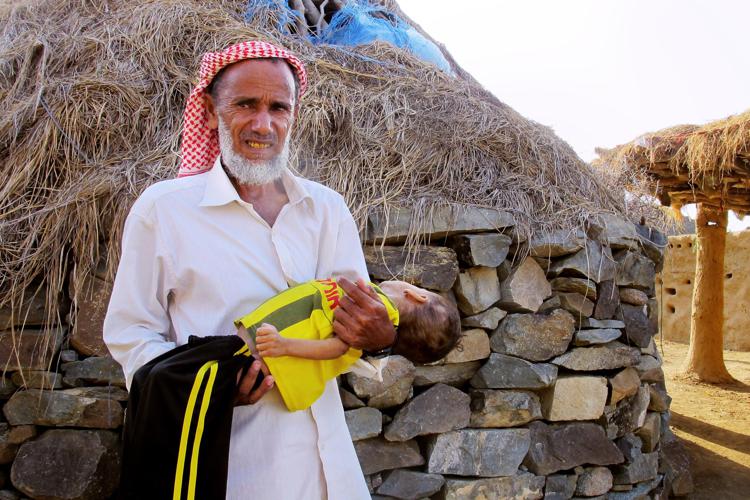 Ahmed Sadek carries his severely malnourished 2-year-old grandson, Osama Hassan, in remote Bani Saifan, Yemen. The family cannot afford to take him to a hospital.   Photo by Sudarsan Raghavan/ - The Washington Post