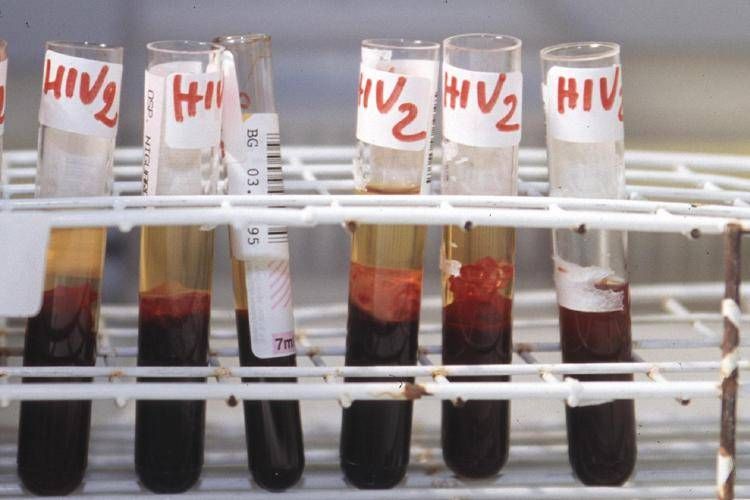 "Hiv pandemia da 40 anni, giovani a rischio"