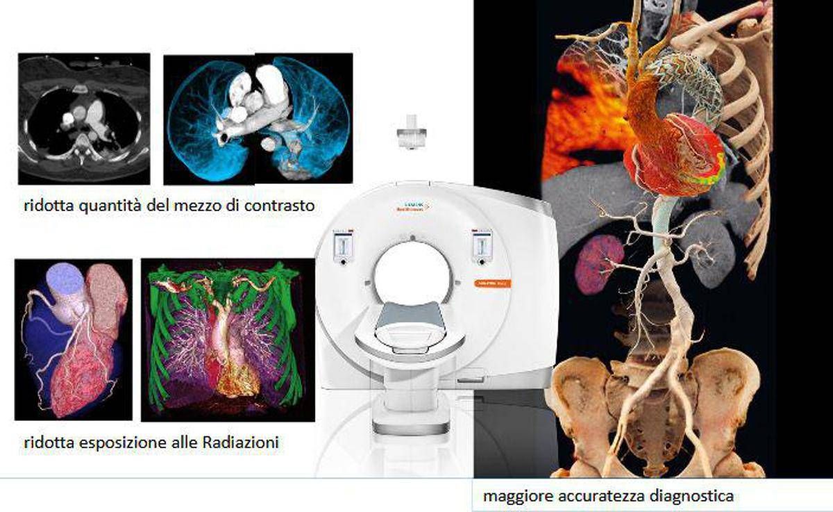 Al Gemelli Molise una nuova tac di ultima generazione per esami più rapidi e meno radiazioni