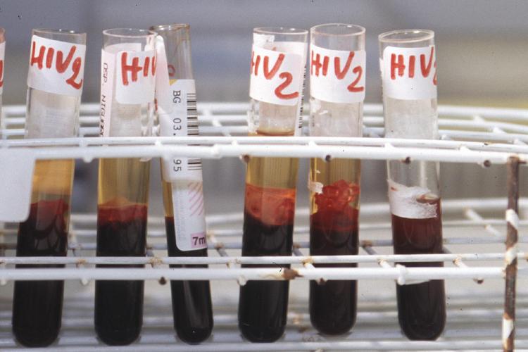 'Aids 2021', un test online per una corretta informazione a 40 anni dalla scoperta primi casi