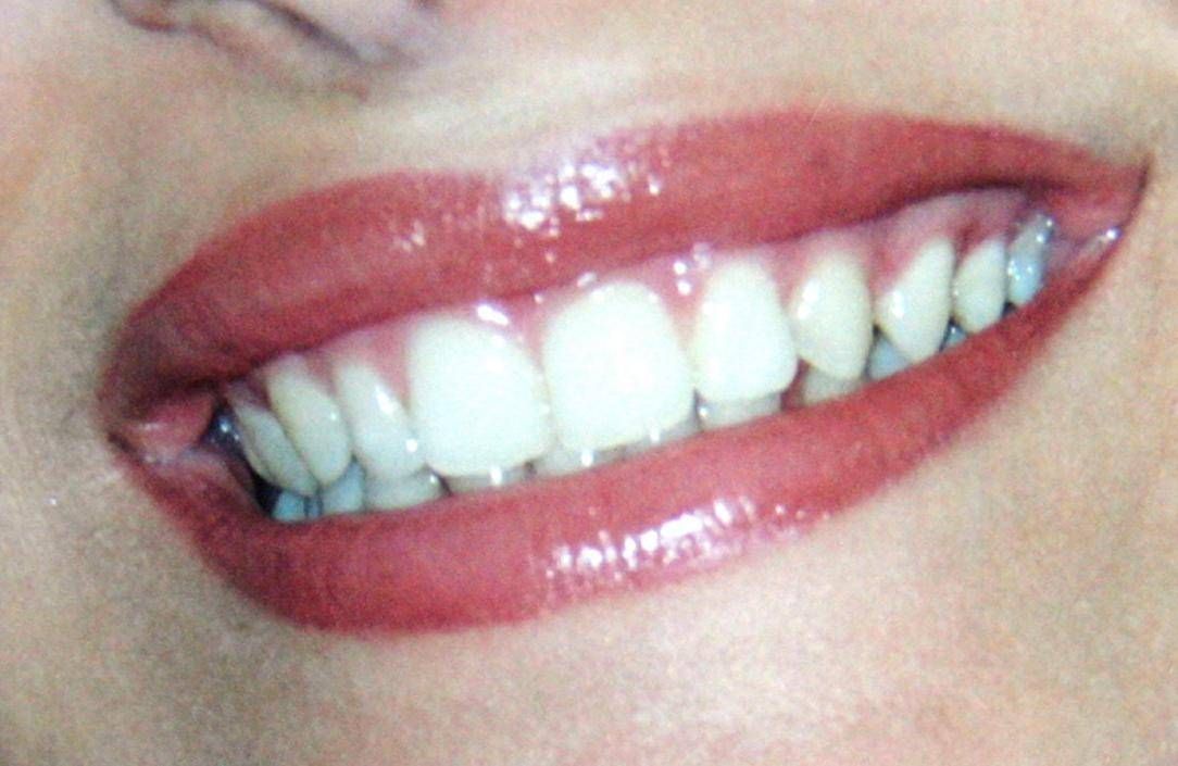Dentista senza prenotazione a Roma, all'Isola Tiberina visite immediate per urgenze e controlli
