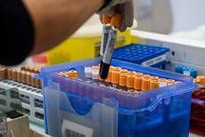 virus provetta sangue afp