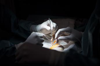 Effetto Covid sul ritocco di bellezza: liposuzione l’intervento più richiesto