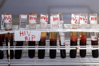 Hiv, Di Perri: “Terapia a 3 farmaci efficace e tollerata a lungo termine”