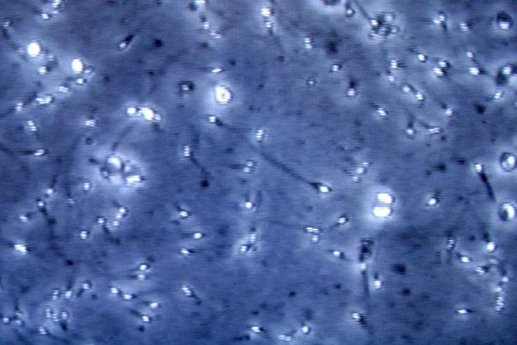 Spermatozoi al microscopio - (Fotogramma)