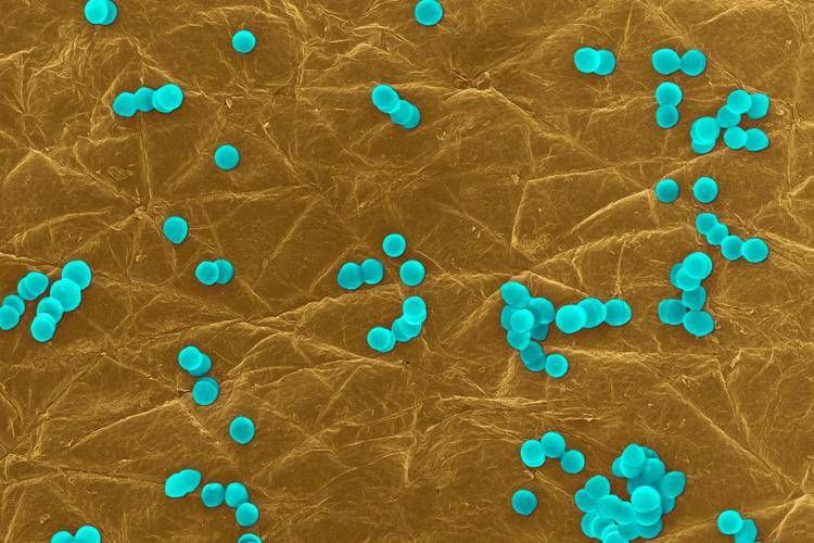 Ecdc: in Ue 100 morti al giorno per batteri resistenti ad antibiotici