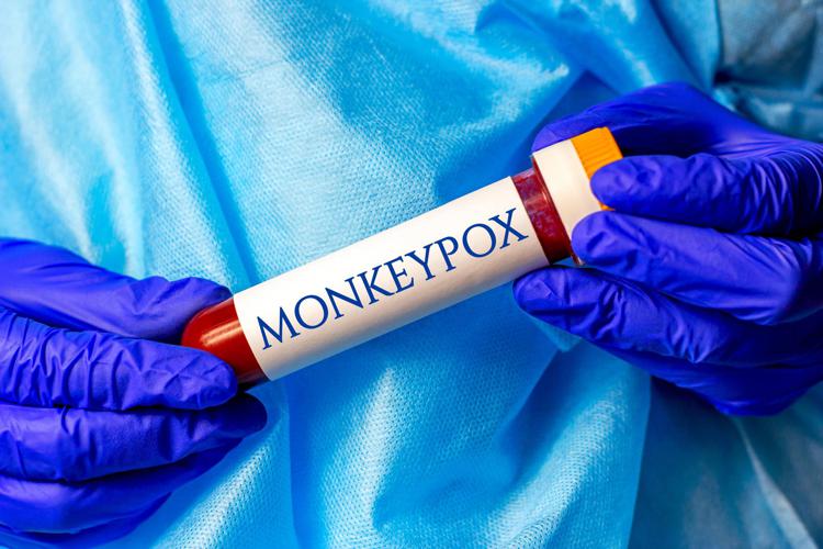 Vaiolo scimmie, ok Ema a vaccino vaiolo anche per Monkeypox