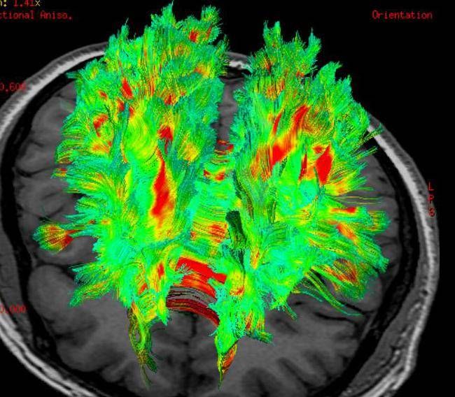 Fat and brain talk, the discovery of scientists