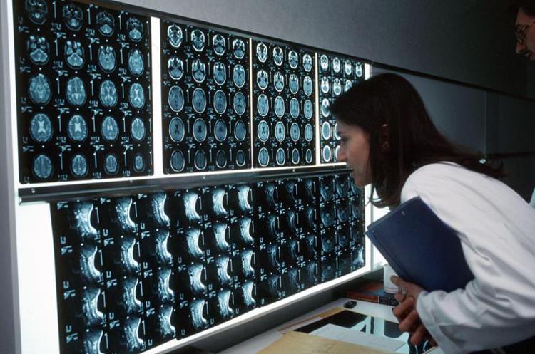 Consip, al via nuovi contratti per 348 apparecchiature di radiologia