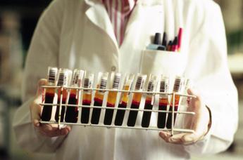 Ipercolesterolemia, a Enna progetto per migliore presa in carico pazienti