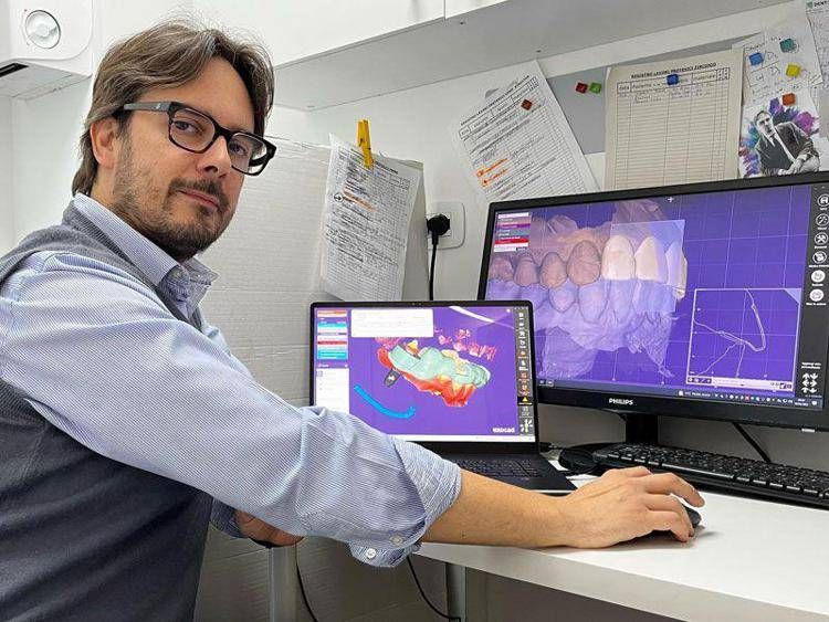 Il Dr. Mocci in fase di programmazione e elaborazione del design implanto-protesico con i software Exocad