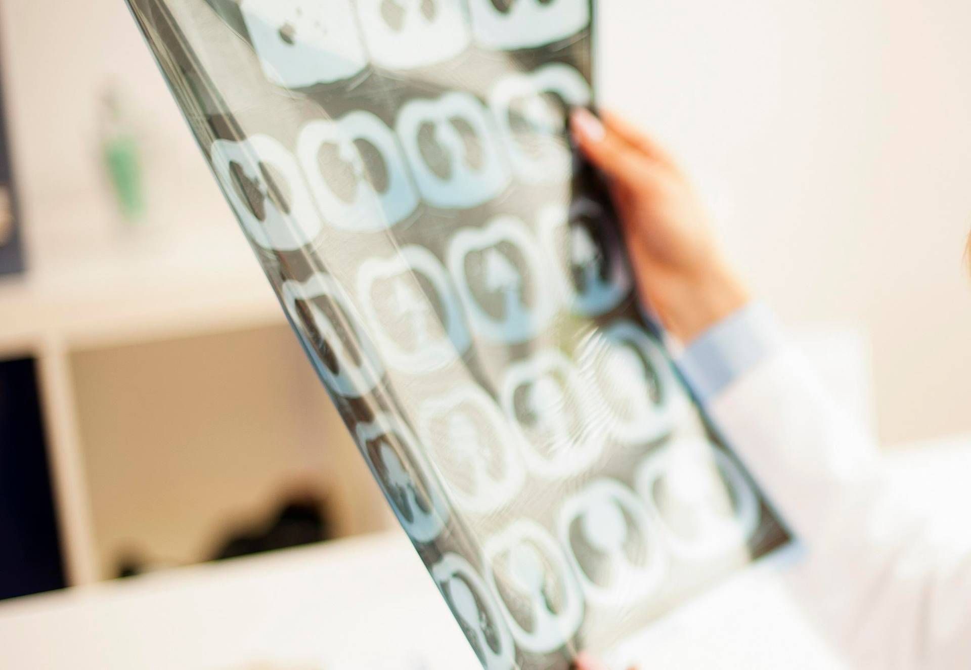 Neurologist Silvestrini "You can save life and brain in stroke