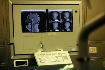 Disonesti e bugiardi, gli interruttori nel cervello