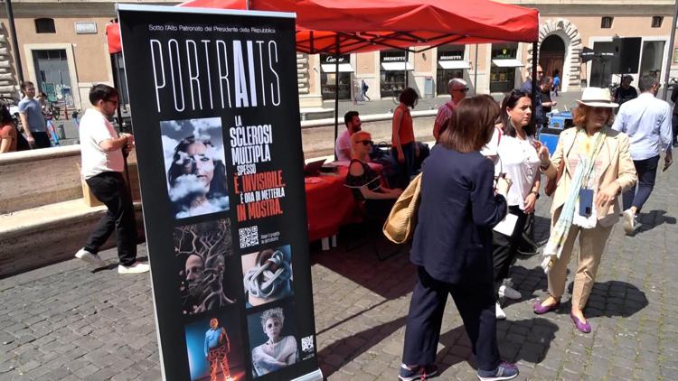 'PortrAits', immagini Ai svelano i sintomi oscuri della sclerosi multipla