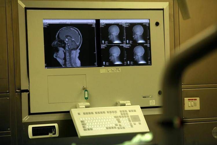 Malattie rare, nuove possibilità di cura per la neuromielite ottica