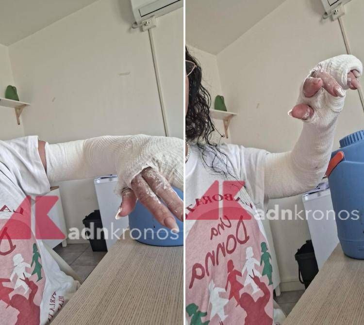 Far West Roma, a Tor Bella Monaca aggredita una volontaria