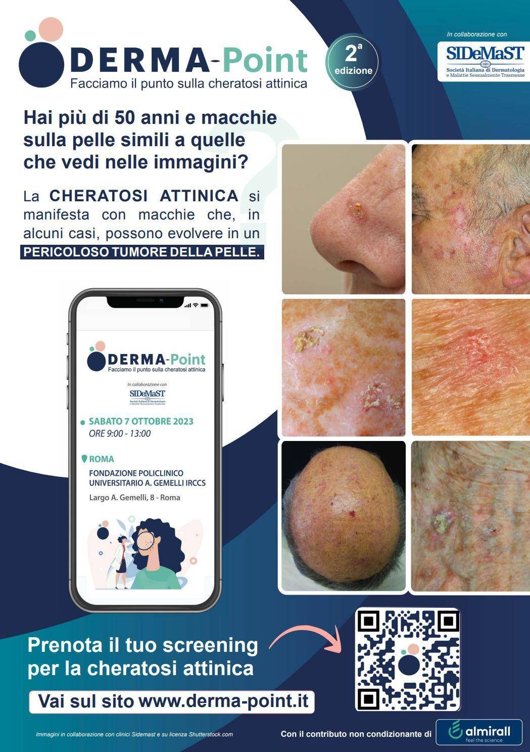 Raising Awareness: Early Diagnosis of Actinic Keratosis Can Prevent Skin Cancer