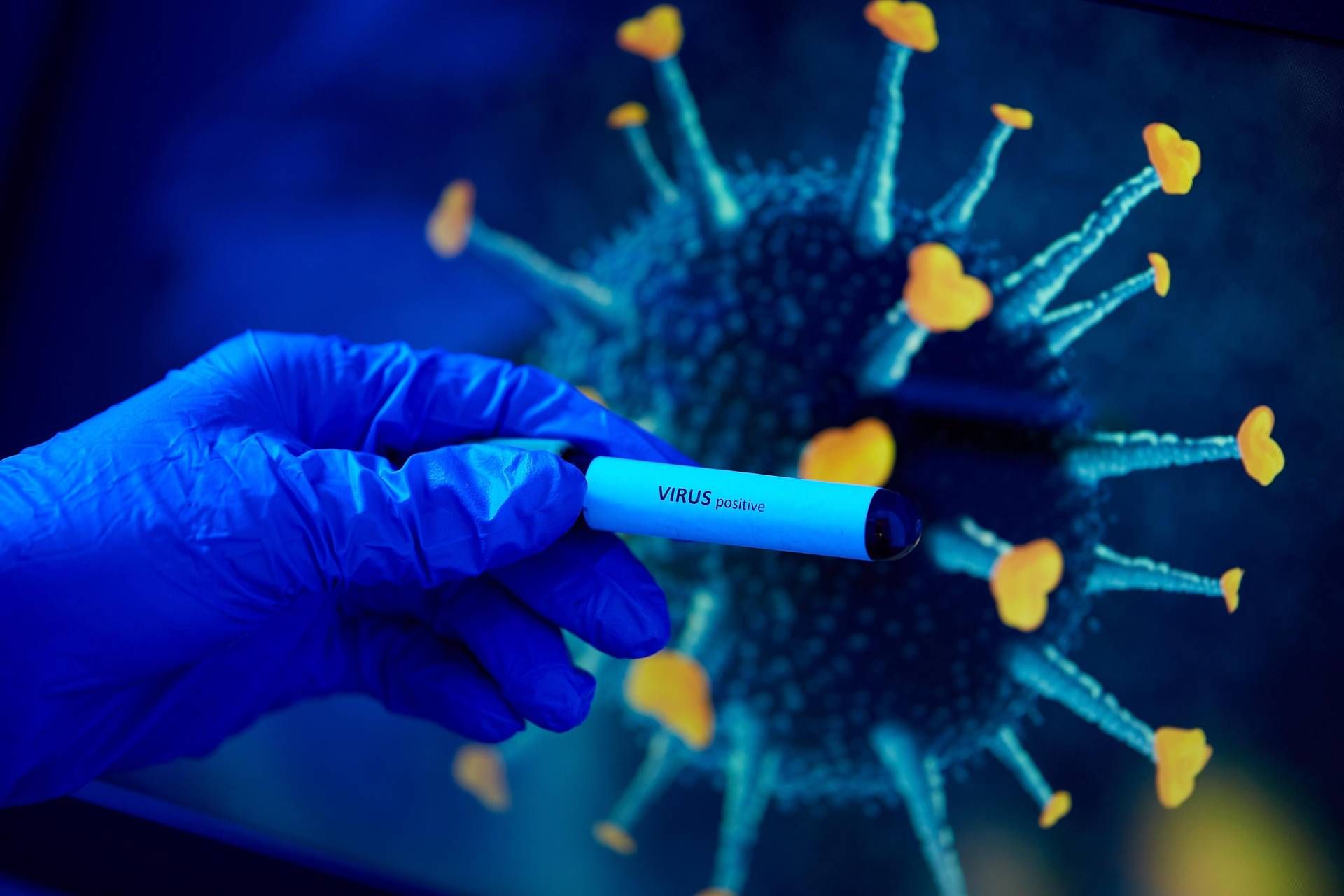 Rise in Covid19 Cases in Italy, but Still Limited Weekly Monitoring