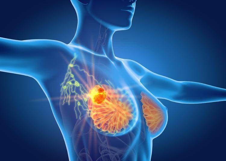 Per cancro seno la cura che arriva dal gelo, Ieo: 