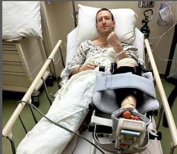 Mark Zuckerberg in hospital, undergoing surgery for an injury: what happened