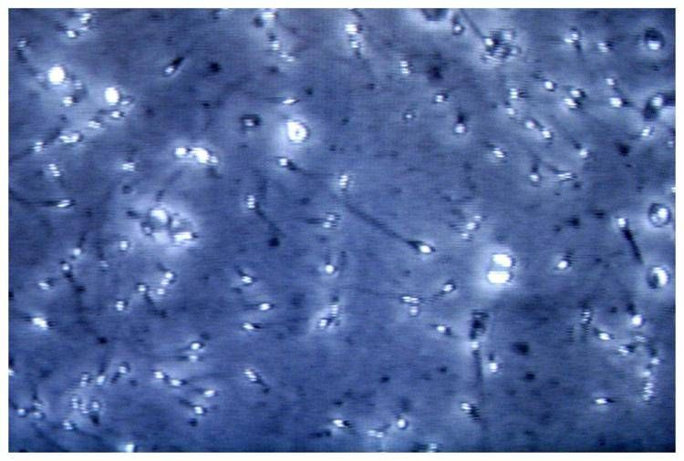 Spermatozoi al microscopio - Fotogramma