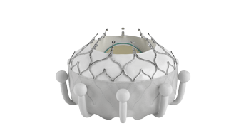 Tricuspid regurgitation, CE mark for Evoque transcatheter system