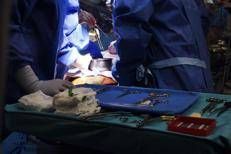 Trapianti, a Pisa evento mondiale, prime linee guida sicurezza donatore vivente di rene