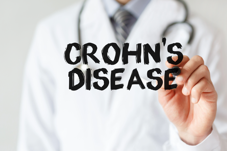 Un'immagine associata alla malattia di Crohn