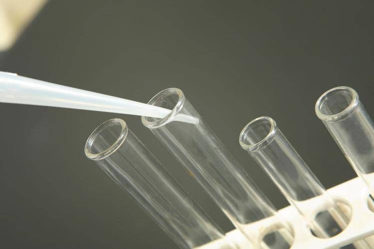 Test antidoping