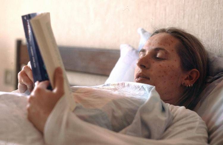 Ragazza con il morbillo - (Ipa)