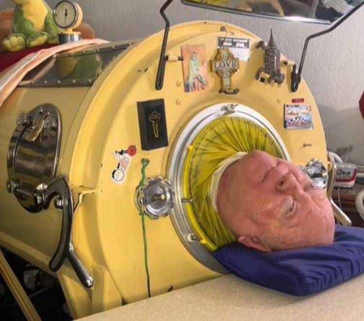 E' morto Paul Alexander, aveva 78 anni: per tutta la vita nel polmone d'acciaio E' morto Paul Alexander, aveva 78 anni: per tutta la vita nel polmone d'acciaio
