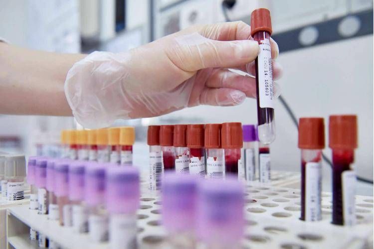 Alert su difterite in Ue, l'infezione continua a colpire in Europa