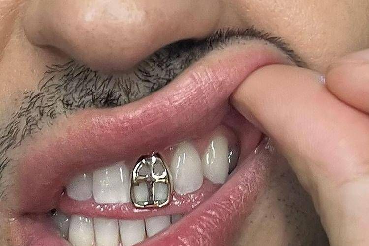 Mahmood  ha postato la foto del suo grillz - (Fotogramma)