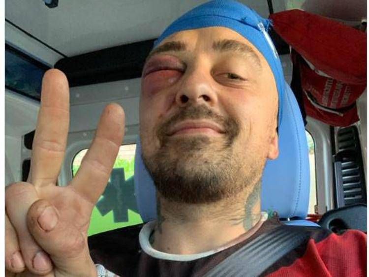 Chef Rubio aggredito sotto casa: "Mi hanno massacrato di botte"