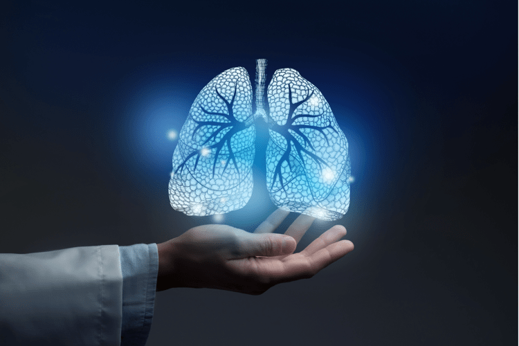 Tumori, Fondazione Fonicap: "Lung unit per tutti i pazienti con cancro polmone"