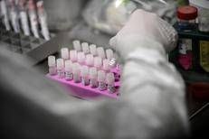 Covid test - Afp