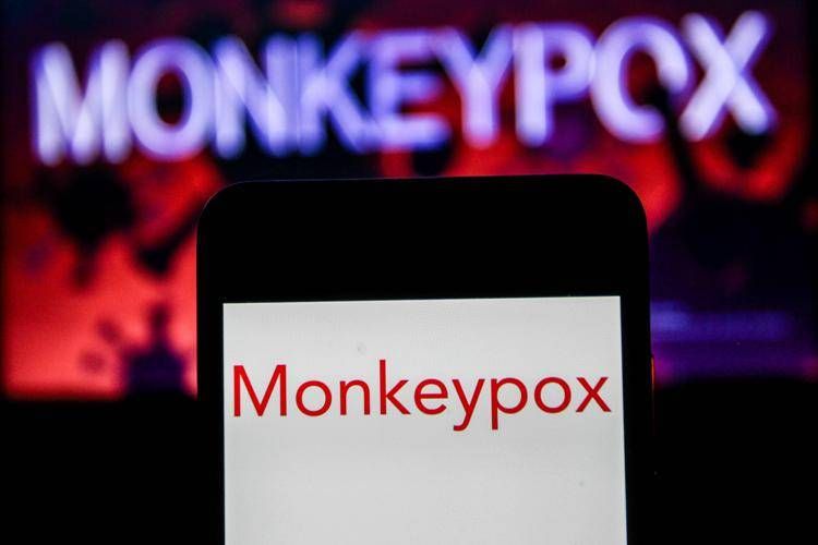 Monkeypox - (Fotogramma)